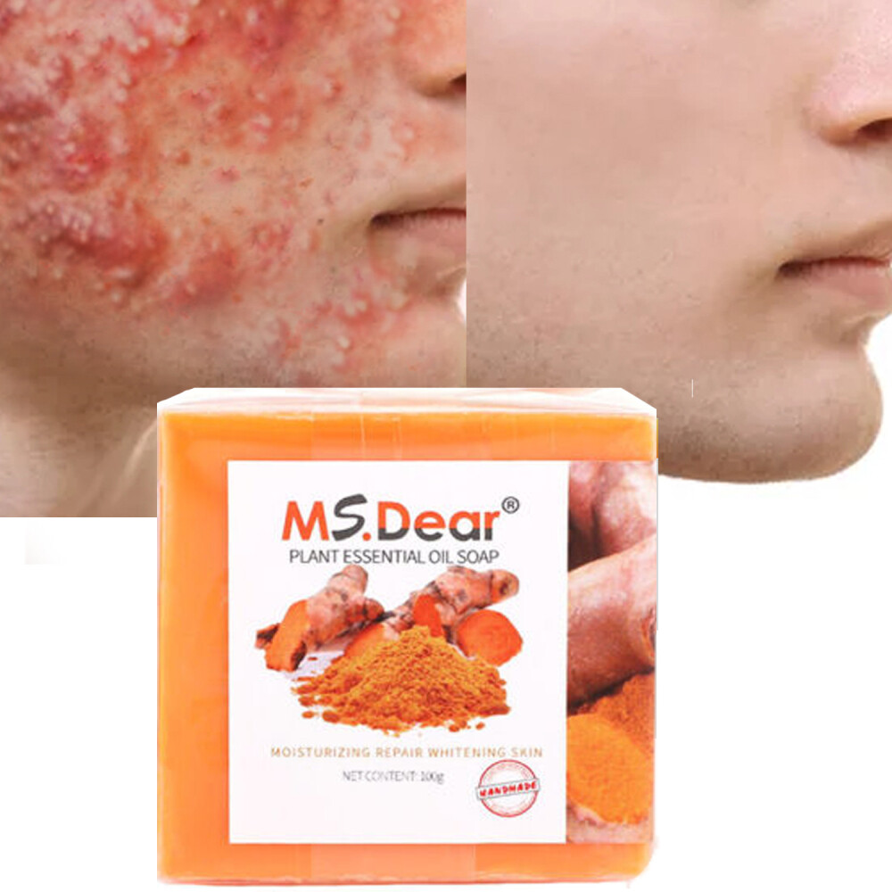 Tumeric Soap Skin Whitening Dark Spots lightening Acne Brightening Turmeric USA