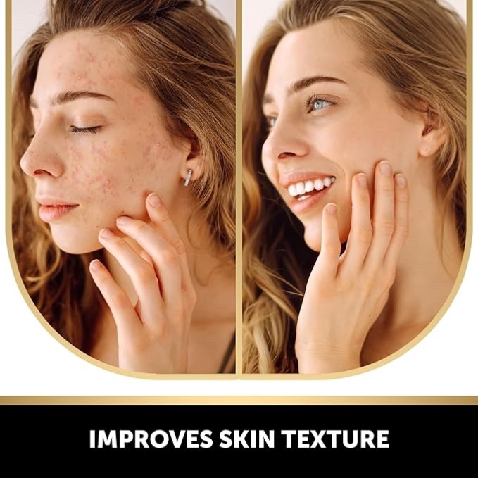 VALITIC 2 Pack Kojic Acid Soap Vitamin C Retinol + 2 Exfoliating Gloves