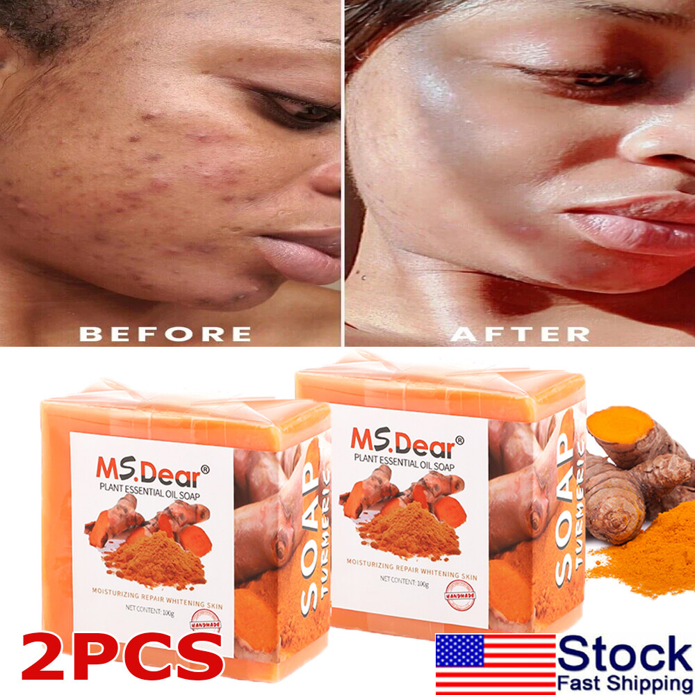 2X 100g Tumeric Soap Skin Whitening Dark Spots lightening Acne Brightening Soap