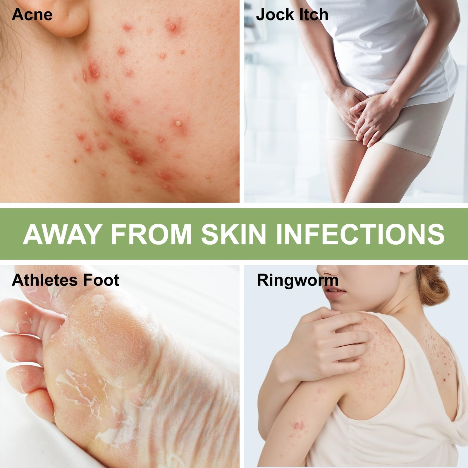 Antifungal Medicated Soap Bar, Athletes Foot Jock Itch Ringworm Yeast Infection