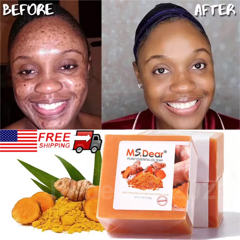 4PCS Tumeric Soap Skin Whitening Dark Spots lightening Acne Brightening Turmeric