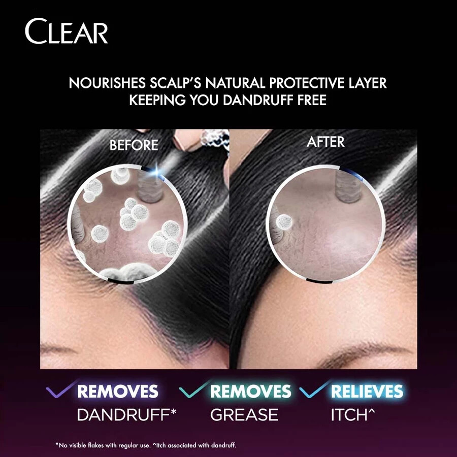 Clear Sakura Fresh Anti-Dandruff Scalp Care Cooling Fresh Shampoo 370ml 3x