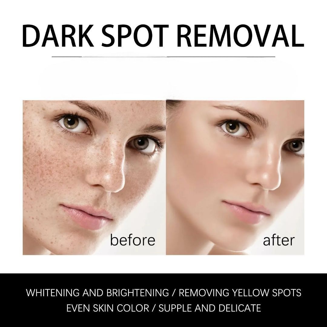 3-pk Niacinamide Brightening Soap Anti-Dark Spot Cleanser, 110g [USA Stock]