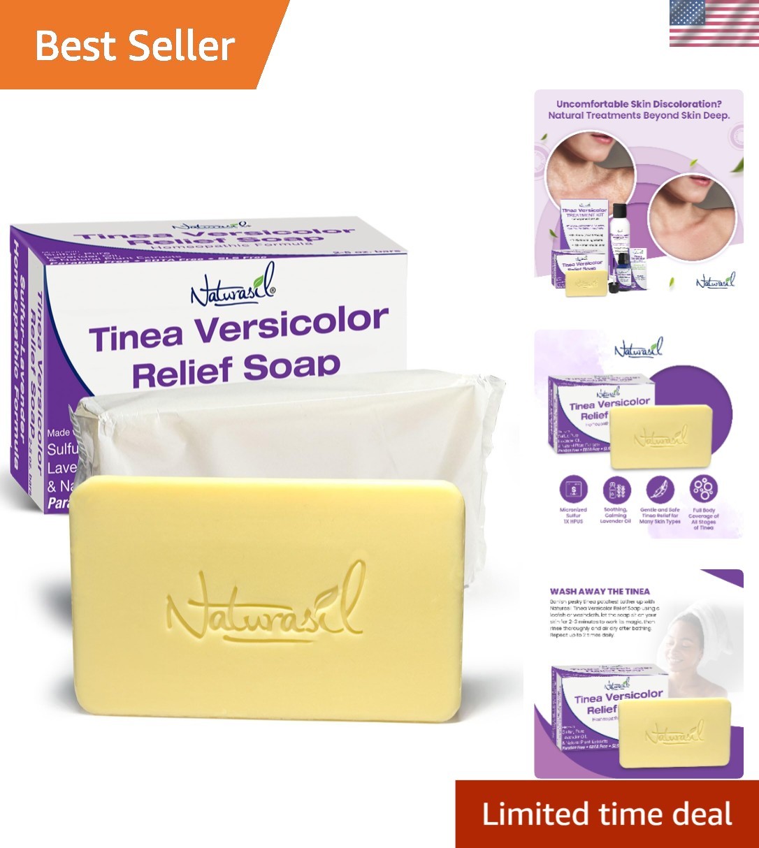 Natural Tinea Versicolor Soap 2-Pack | Lavender Scent, Skin Soothing Formula