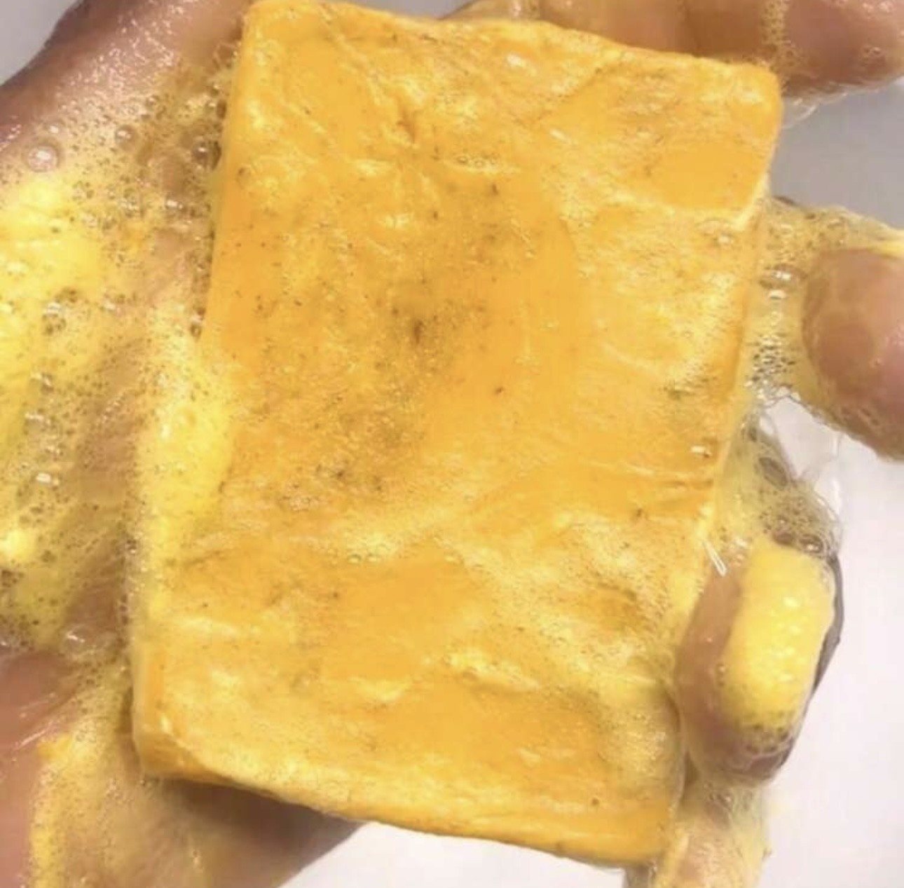 TUMERIC & KOJIC (2-PK!) Brightening Soap – Fades Hyperpigmentation & Dark Spots!