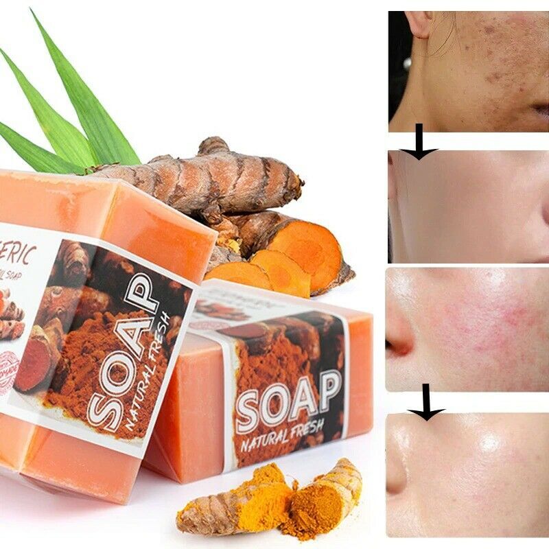 1/2PCS Tumeric Soap Ginger Anti-Acne Dark Spots Removal Body Whitening Soap Bar