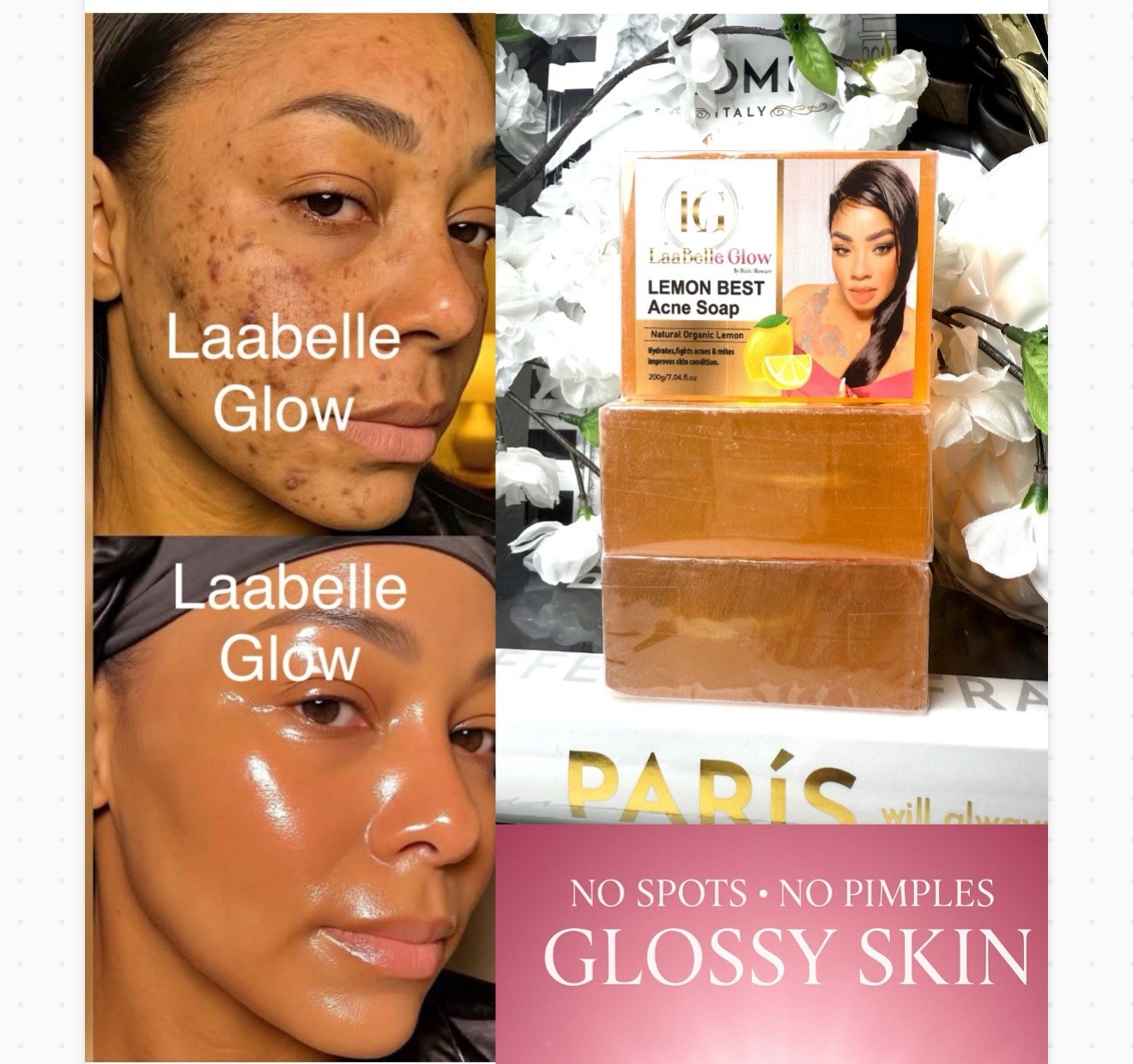 3x Handmade Lemon Soaps Skin Whitening Dark Spots Acne Brightening-Glossy 200G
