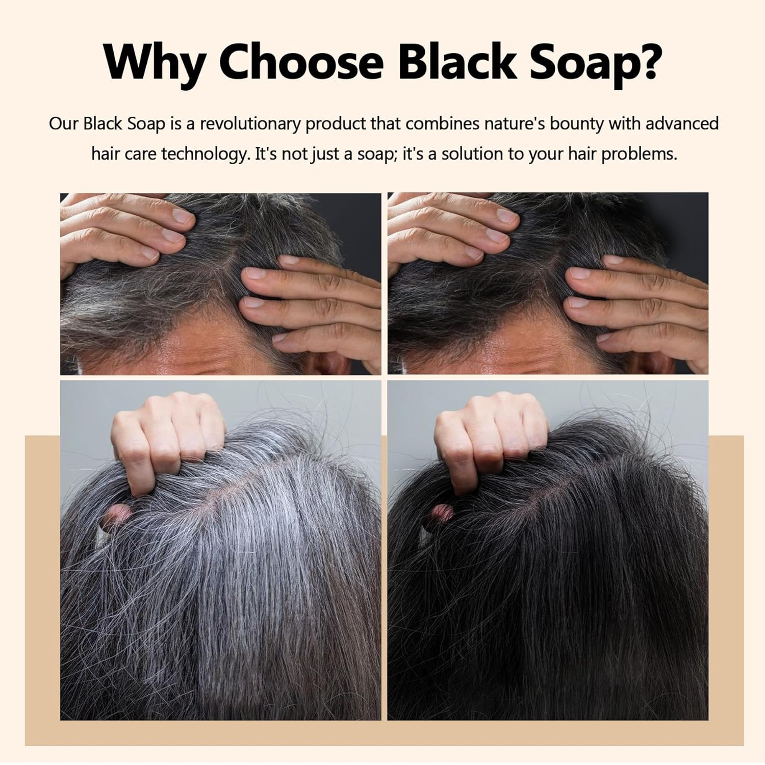 2 Pcs Herbal Emberless Black Soap for Gray Reverse, Fo Ti Castor Oil for Darkeni