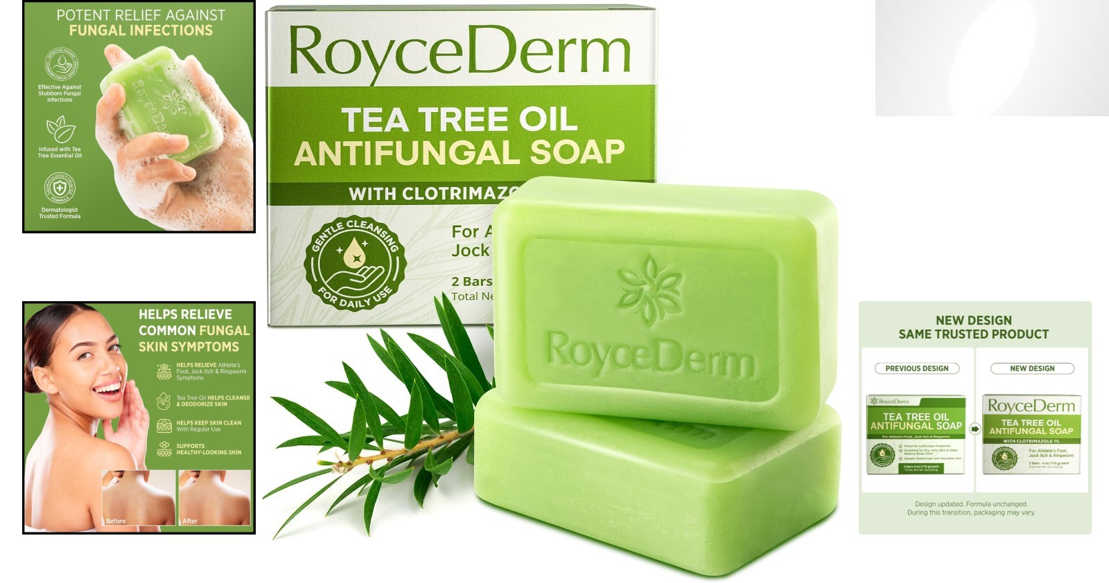 Roycederm Antifungal Antibacterial Tea Tree Soap | Treatment Soap for Face &…