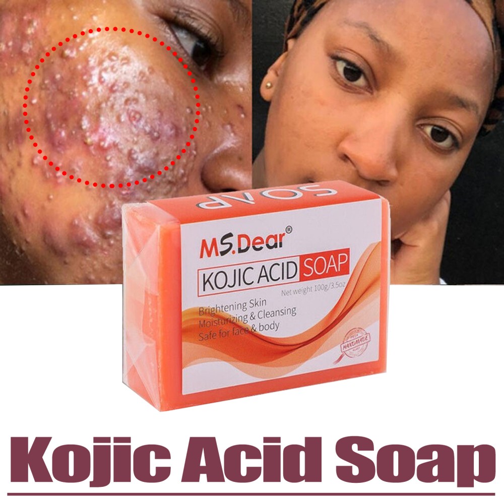 Kojic Acid Dark Spot Remover Soap Bars with Vitamin C Retinol, Collagen Turmeric