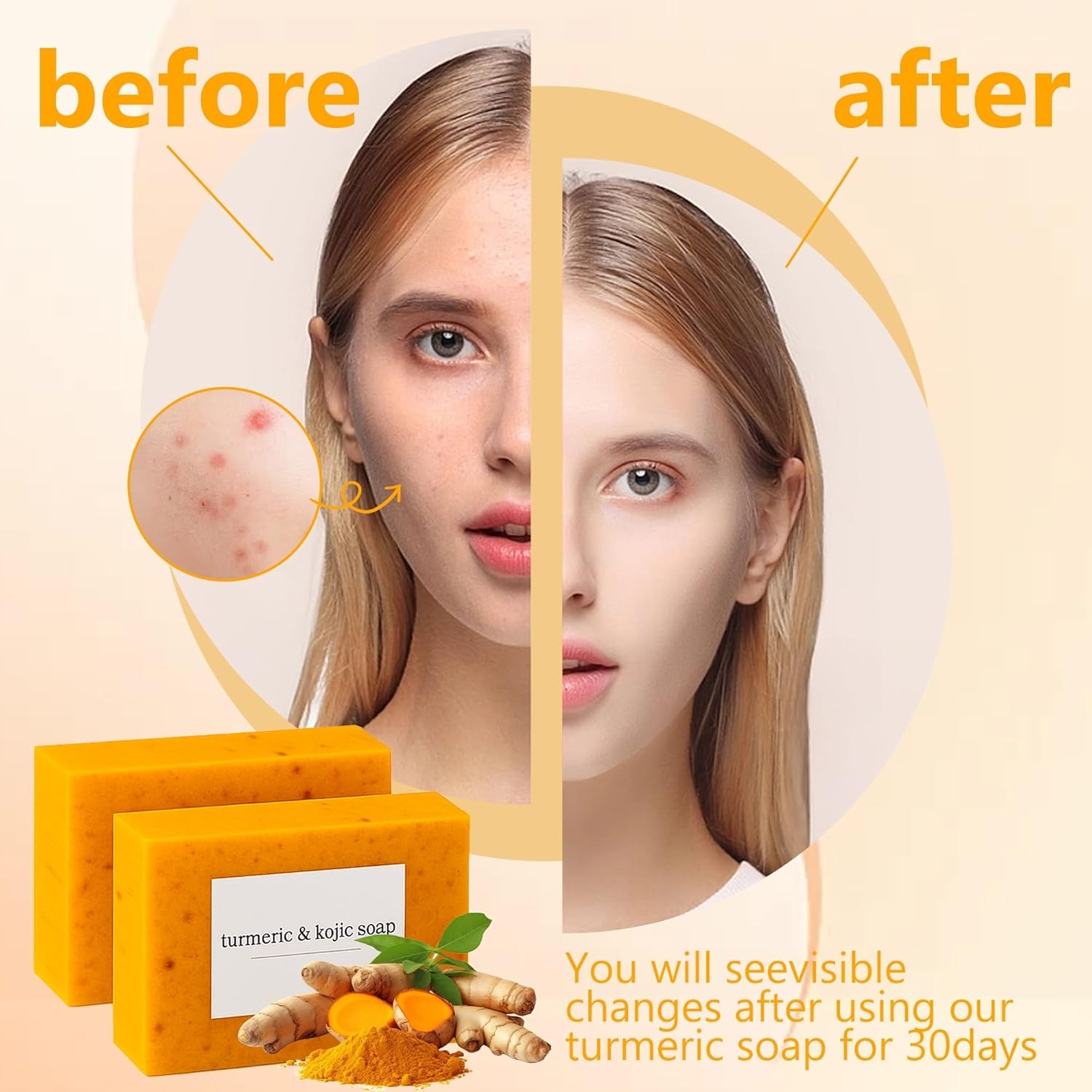 3-Pack Turmeric Glow Soap Bar – Lemon & Kojic Acid, Removing Dark Spots