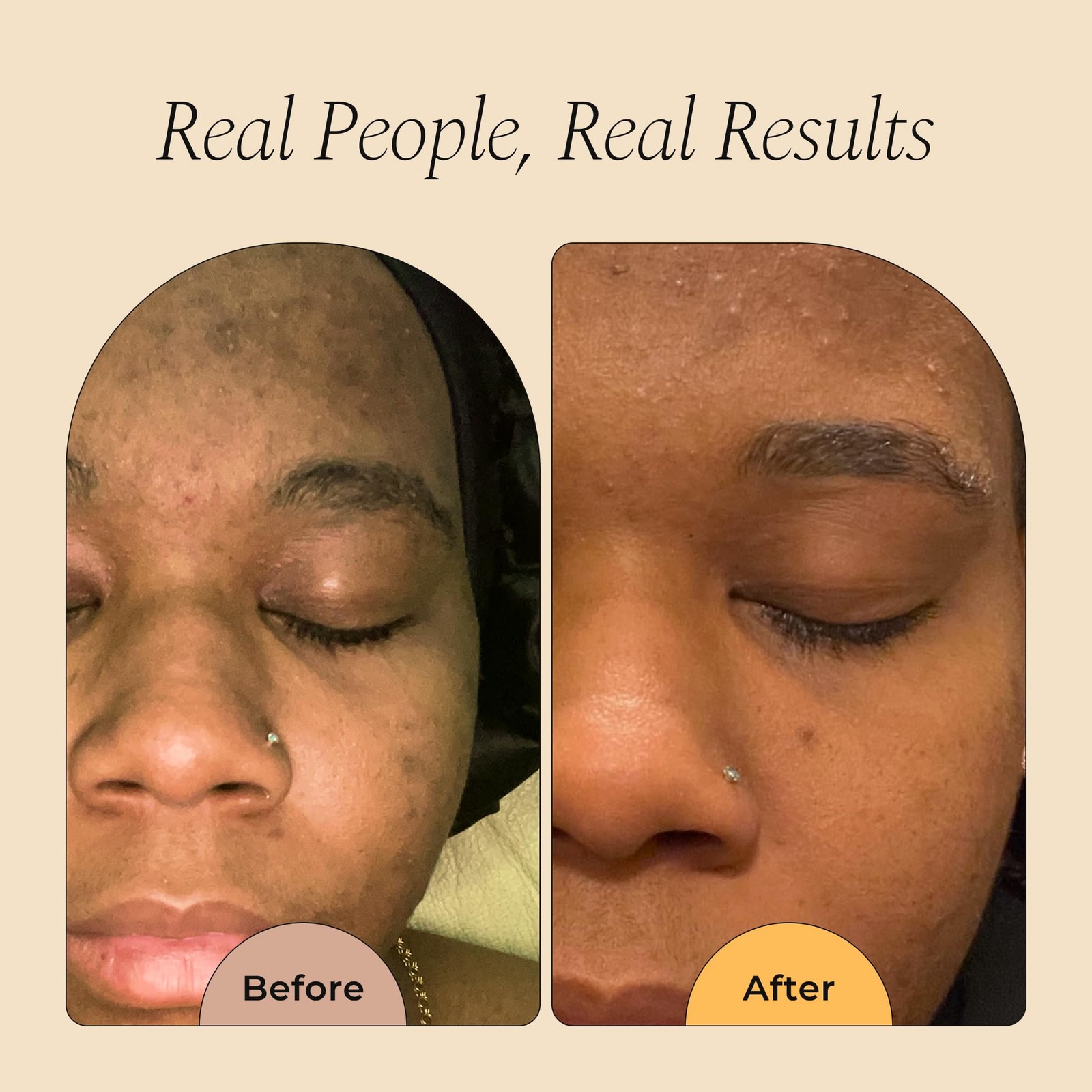 Glo Melanin Organic Turmeric Soap for Dark Spots Soap for Face All Natural Face