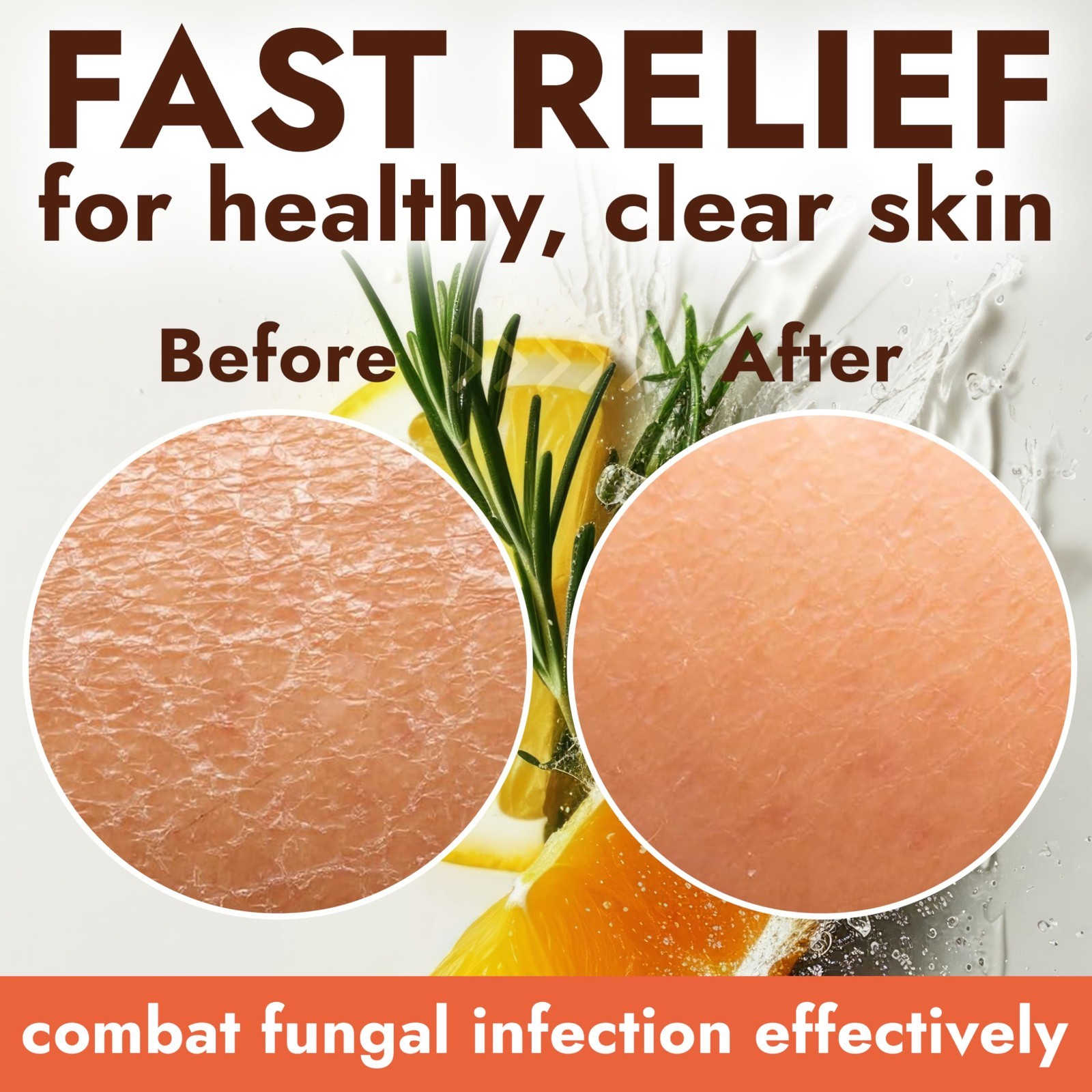 Antifungal Soap with Lemon Oil – Jock Itch & Ringworm Treatment, 1% Tolnaftate,