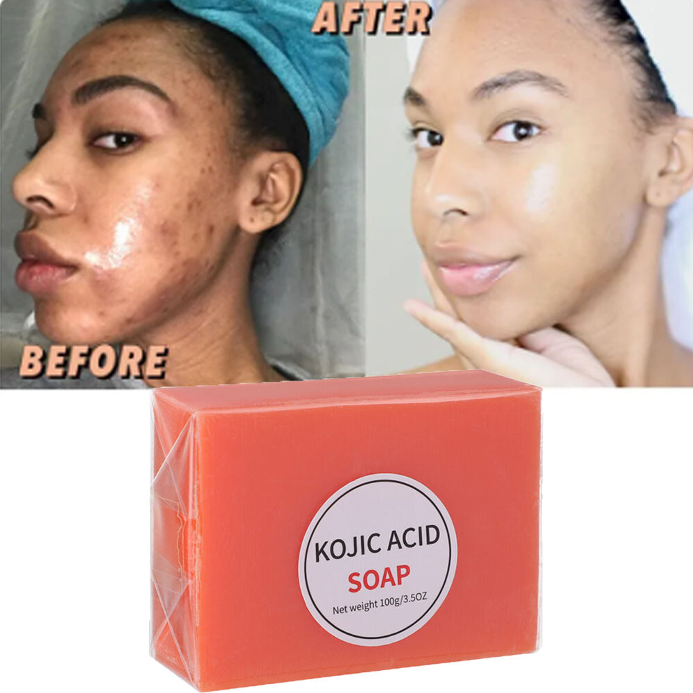 5/3x Kojic Acid Soap Dark Spot Whitening Bleaching Lightening Face & Body Skin