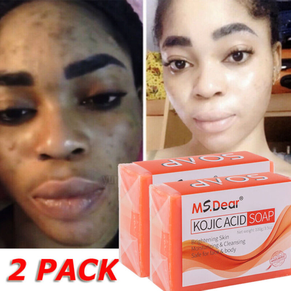 2Pcs Kojic Acid Soap Acne Dark Spot Remover Skin Lightening Whitening Face Body