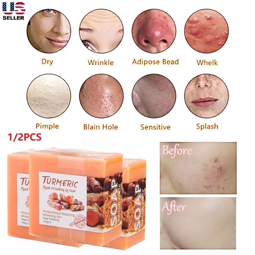 2×Tumeric Soap Ginger Anti-Acne Dark Spots Scars Removal Body Whitening Soap Bar