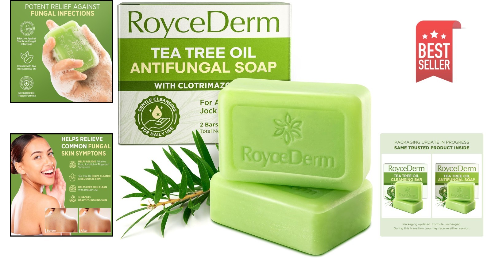 Roycederm Antifungal Bar Soap – Tea tree Oil Soap – Athlete’s Foot Treatment