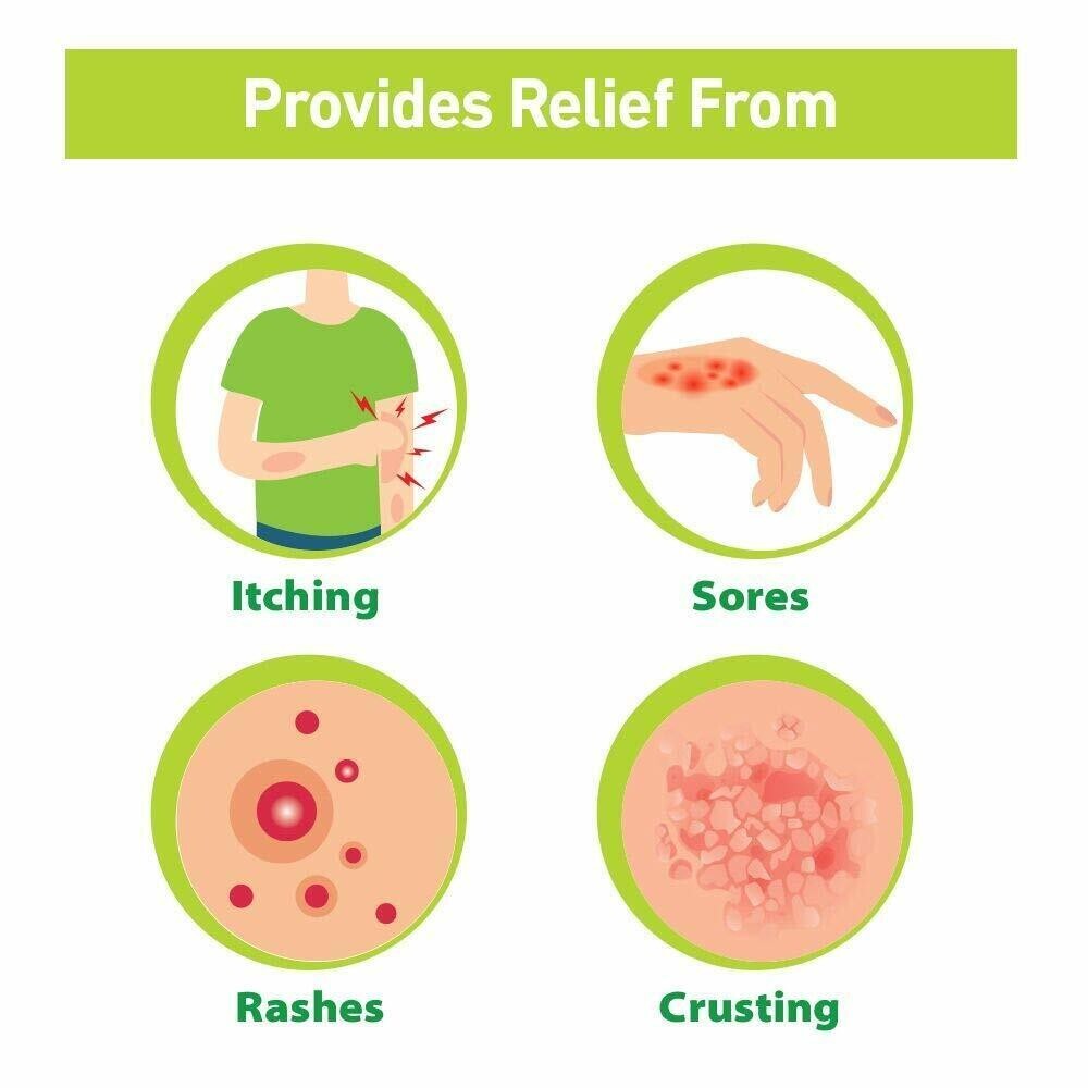 Tetmosol Medicated Soap- fights skin infections, itching with lime 100 gm X 4.