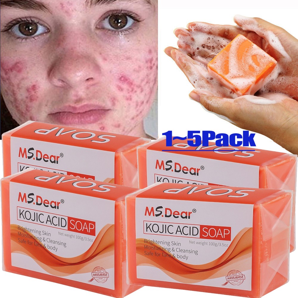 100g Acid Soap Dark Spot Remover Skin Lightening Face Whitening Body Bleaching
