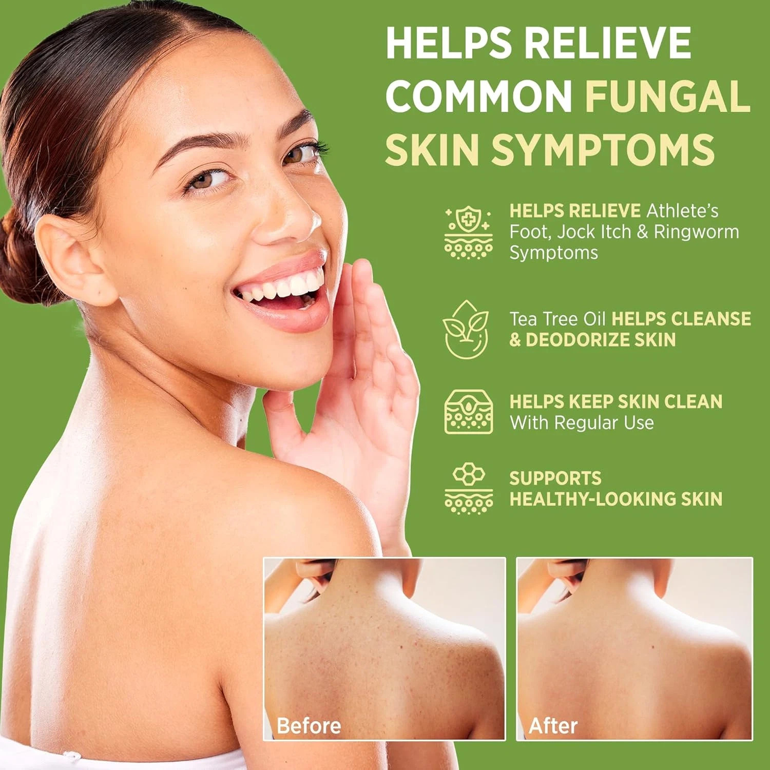 Roycederm Antifungal Antibacterial Tea Tree Soap | Treatment Soap for Face &…